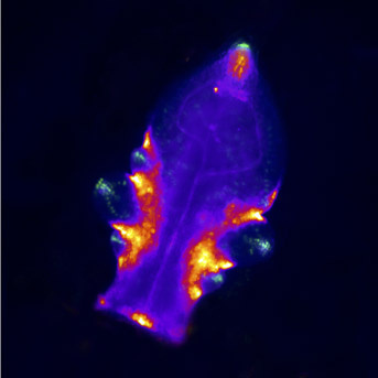 Facteurs de Transcription et Architecture