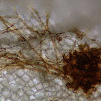 Interactions Azote Pathogènes