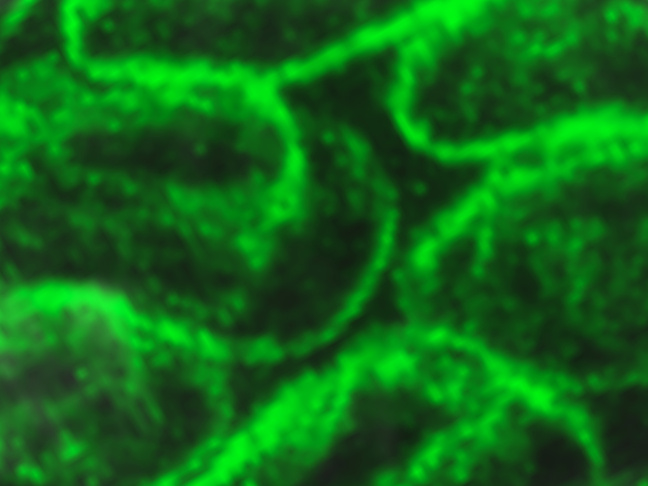 Localisation of cellulose synthase catalytic subunit proteins in developing seed coat epidermal cells