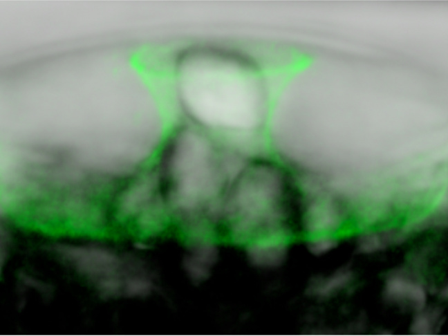 Localisation des protéines pour une sous-unité catalytique de cellulose synthase dans une cellule épidermique des téguments en développement