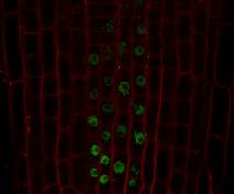 GFP-NLP7 accumulation in nucleus after nitrate addition