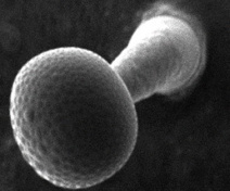 Trichome glandulaire de tomate