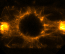 Un PPB dans une cellule racinaire entrant en division