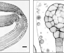 Arabidopsis embryos under confocal microscopy