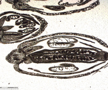 Arabidopsis flower sections