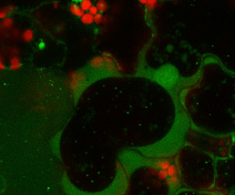 Autophagic bodies in the vacuole of mesophyll cells