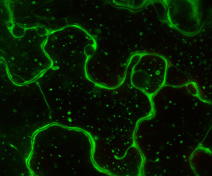 Autophagic bodies in epidermis