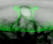 Localisation of cellulose synthase catalytic subunit proteins in a single developing seed coat epidermal cell