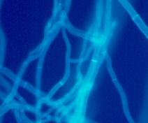 Botrytis cinerea mycelium (calcofluor staining)