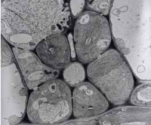 Image en microscopie électronique à transmission du phloème