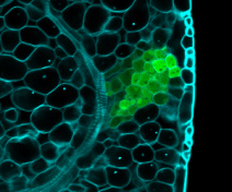 Arabidopsis hydathode expressing a green reporter