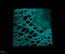3D reconstruction of a vascular bundle