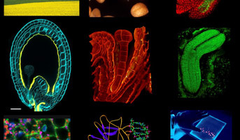Développement et qualité de la graine