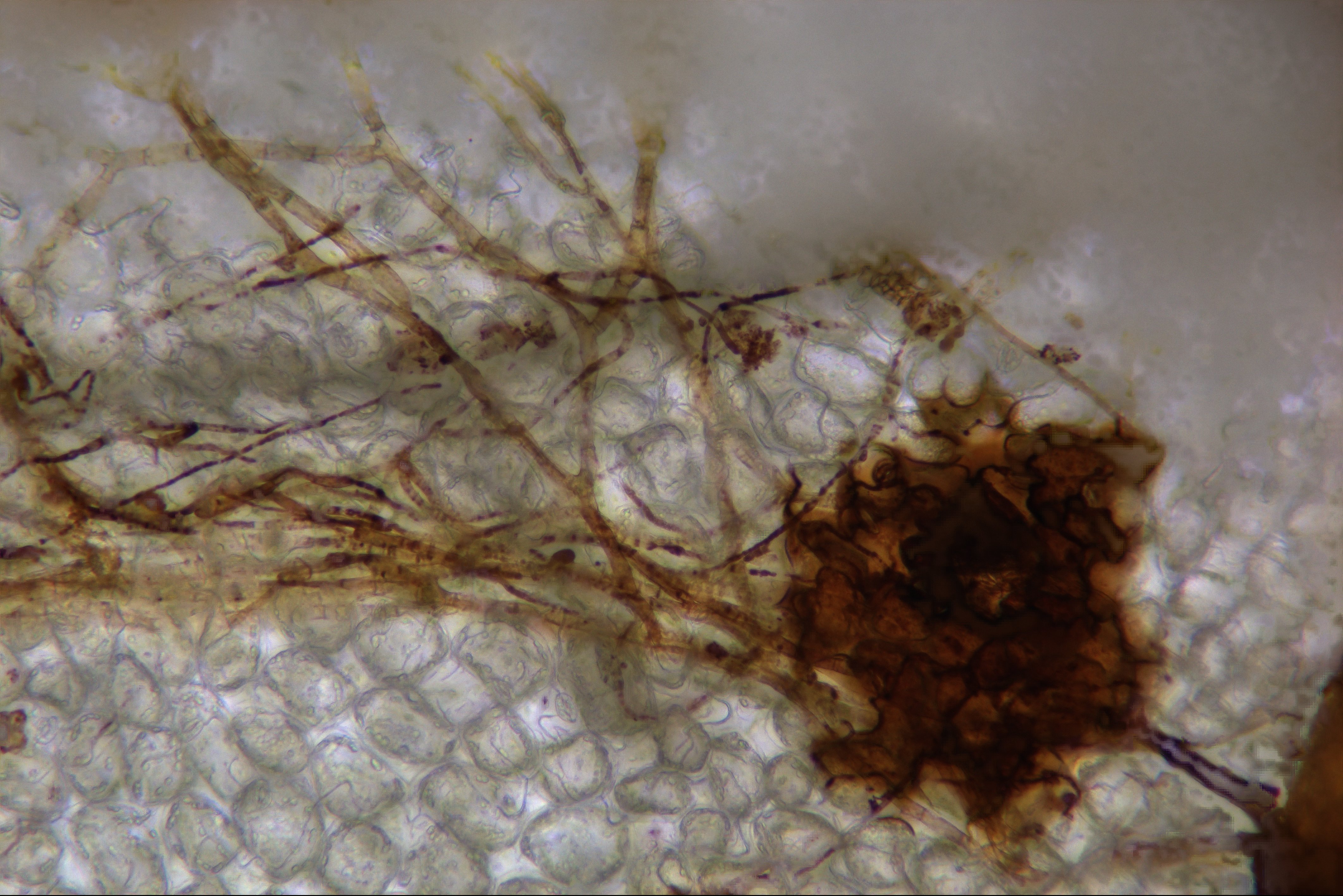 Interactions Azote Pathogènes